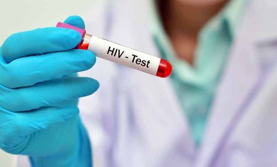 MPF apura corte de verbas do governo federal em programas de combate ao HIV