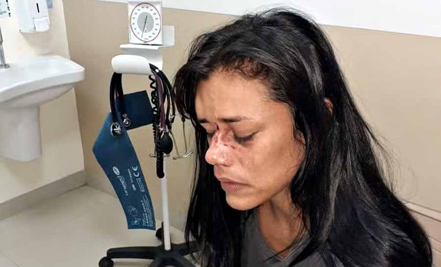 Mulher é agredida a socos pelo ex quando ia para casa da mãe buscar o filho no AC: ‘achei que ia morrer’