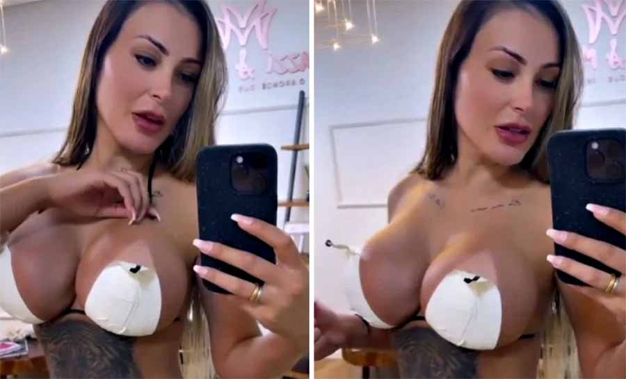 Andressa Urach posa de biquíni de fita após retirar costelas