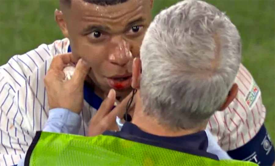 Mbappé sofre fratura no nariz e pode deixar a França na Eurocopa