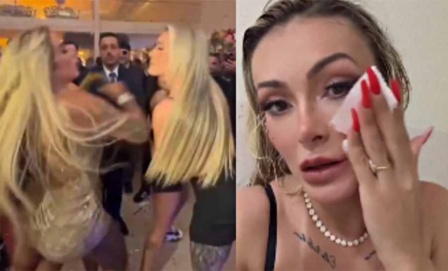 Andressa Urach leva pontos no rosto após briga com Juju Ferrari