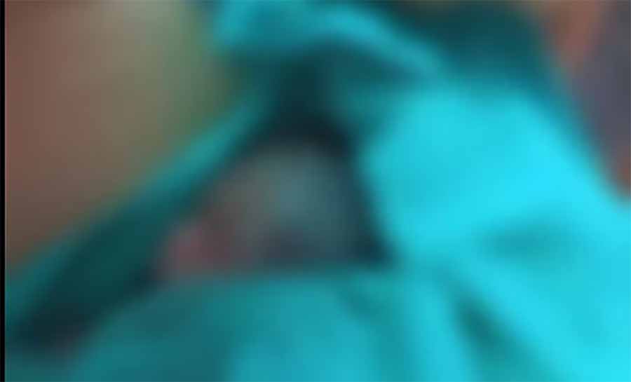 Morre recém-nascido de 5 meses que foi retirado vivo do próprio velório no Acre